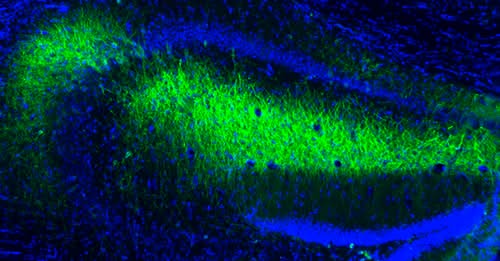Maladies neurodégénératives : et si la clé se trouvait dans les mitochondries ?